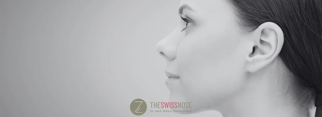 nose-job Zurich