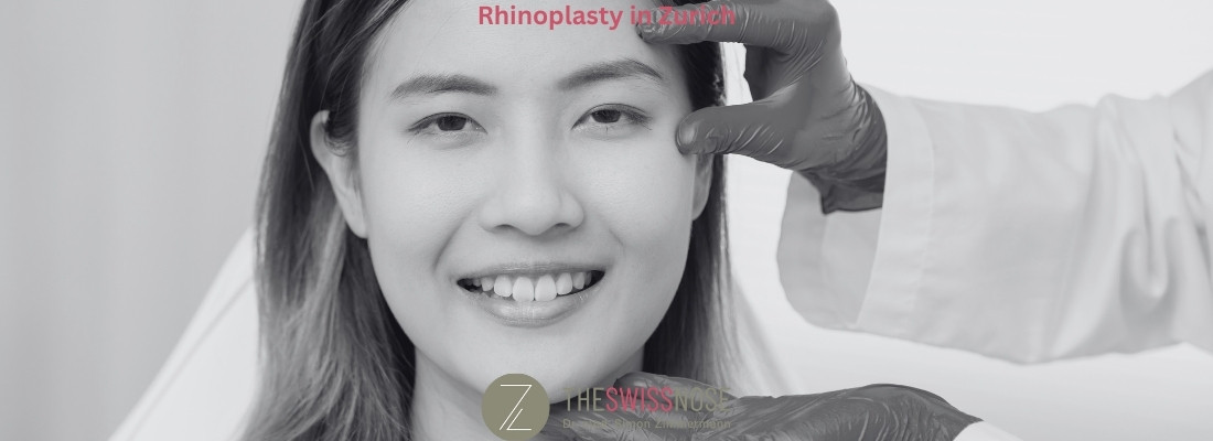 Rhinoplasty surgery Zurich
